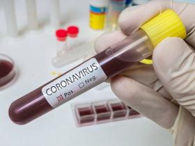 Эпидемиологтар Қазақстанда коронавирустың екінші толқыны болады деп болжап отыр